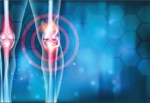 Condroprotezione naturale: prove di efficacia clinica