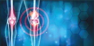 Condroprotezione naturale: prove di efficacia clinica