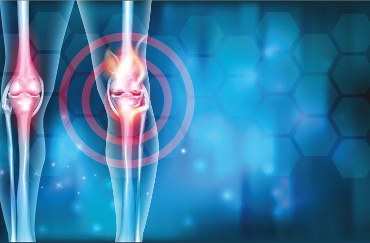 Condroprotezione naturale: prove di efficacia clinica